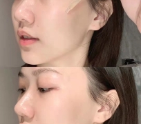 SERUM ESTEE LAUDER 7ML CÓ VÒI