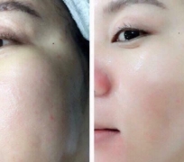 SERUM ESTEE LAUDER 7ML CÓ VÒI